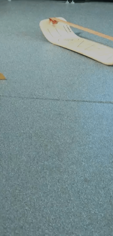 Child-friendly SlackBoard balance training setup
